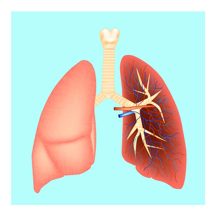 Pulmonary Embolism