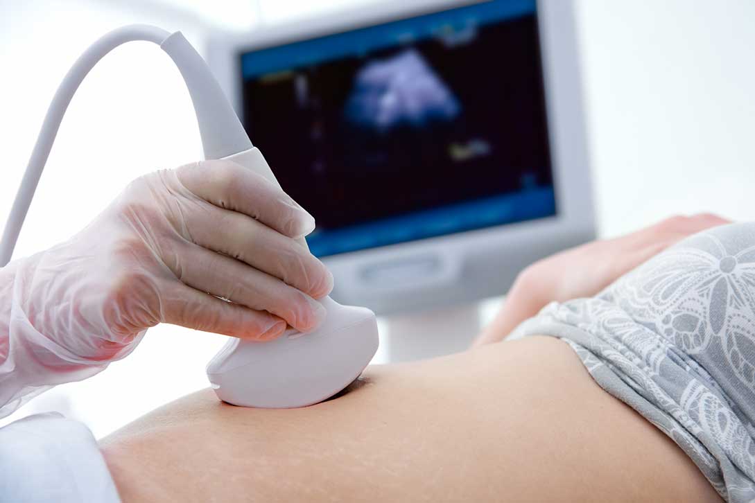 Sonography