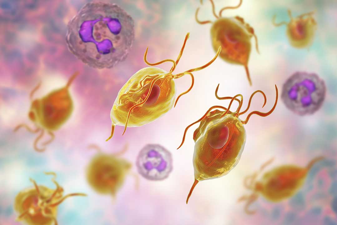 Trichomoniasis